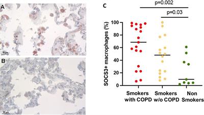 Suppressor of cytokine signaling-3 expression and its regulation in relation to inflammation in Chronic Obstructive Pulmonary Disease